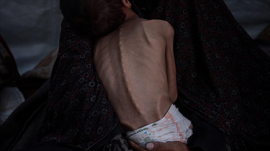 İsrail'in ablukası nedeniyle kıtlık yaşanan Gazze’de açlıktan ölenlerin sayısı 455’e yükseldi
