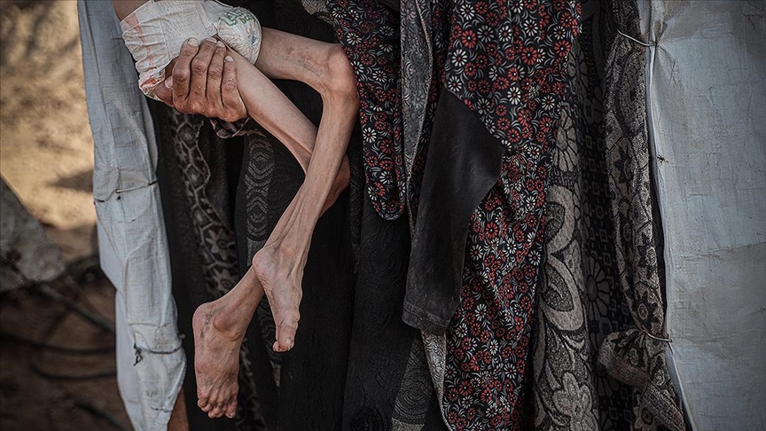 Gaza : 455 personnes tuées par la famine à Gaza, sous blocus israélien