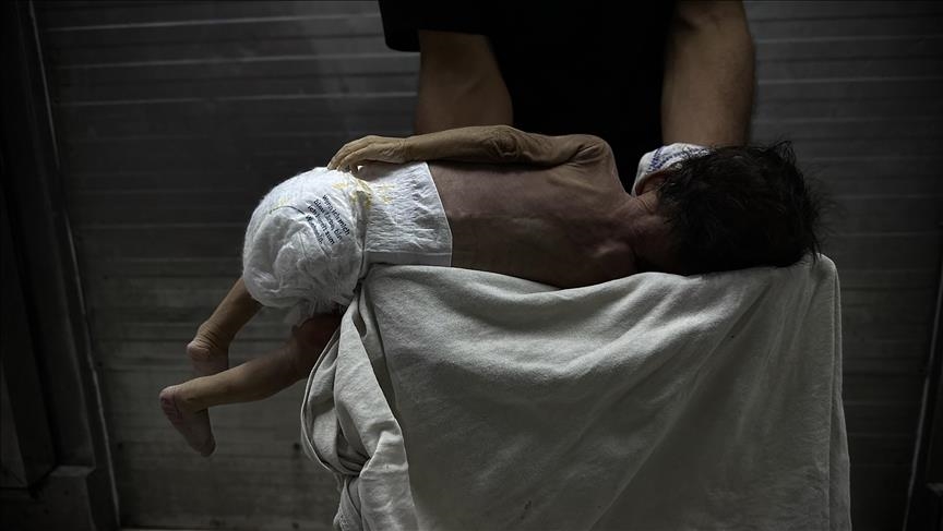 "صحة غزة": ارتفاع وفيات التجويع الإسرائيلي إلى 457 بينهم 152 طفلا