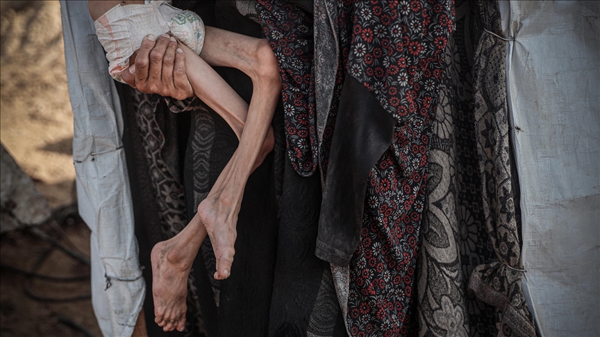 İsrail’in ablukası nedeniyle kıtlık yaşanan Gazze’de açlıktan ölenlerin sayısı 457’ye yükseldi