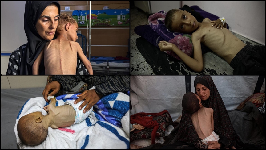 Gazze'de İsrail'in açlıktan ölüme mahkum ettiği çocukların hikayeleri soykırımın boyutunu gösteriyor