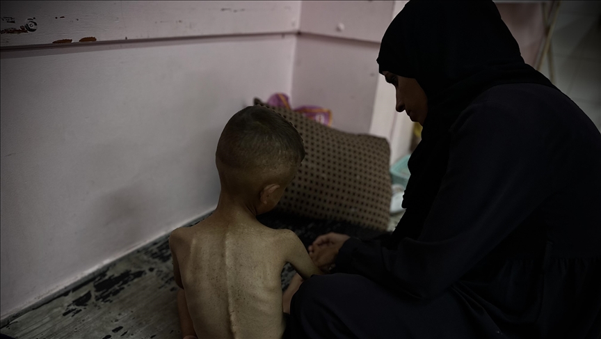 عامان من الإبادة.. إسرائيل تقتل الفلسطينيين بالتجويع الممنهج (تقرير)
