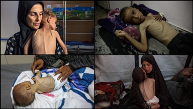 Gazze'de İsrail'in açlıktan ölüme mahkum ettiği çocukların hikayeleri soykırımın boyutunu gösteriyor