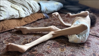 OPINION - Starvation in Gaza: Death by design