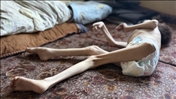 OPINIÓN– El hambre en Gaza: muerte planificada