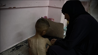 حماس: قرار "العدل الدولية" إدانة لإسرائيل باستخدام التجويع في غزة 