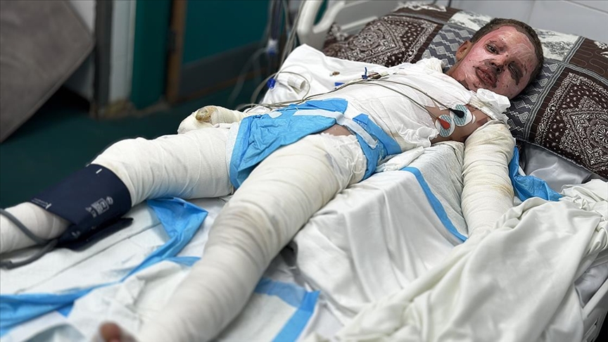 Соништата на малиот Маџд, како и неговото тело, изгореа од неексплодирана муниција оставена од Израел