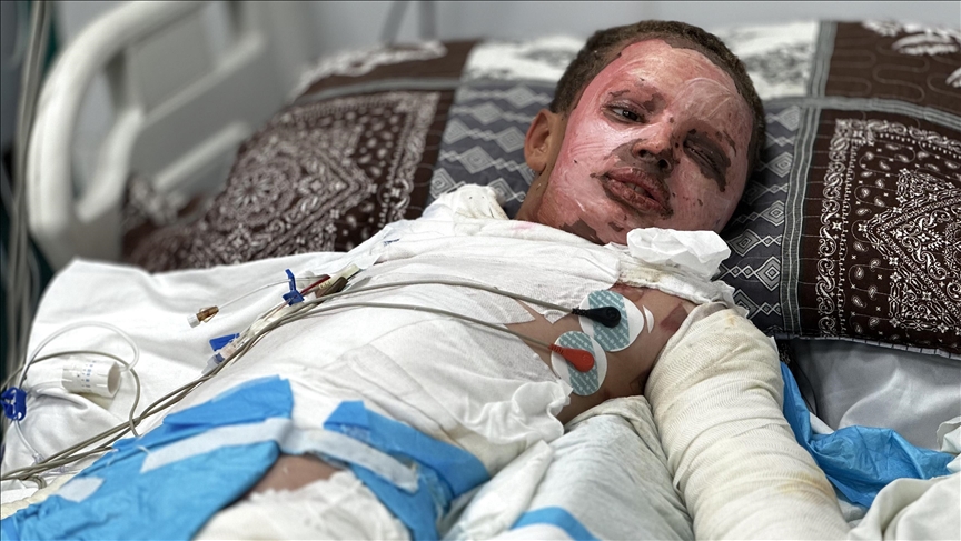 Ëndrrat e Majdit nga Gaza, ashtu si trupi i tij, u dogjën nga municionet e pashpërthyera të lëna nga Izraeli