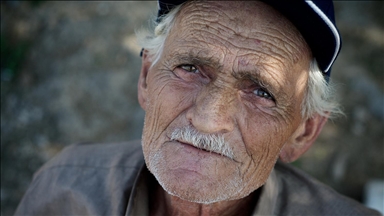 Gray hair linked to body's anti-cancer defense mechanism, study finds