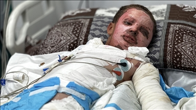 Ëndrrat e Majdit nga Gaza, ashtu si trupi i tij, u dogjën nga municionet e pashpërthyera të lëna nga Izraeli