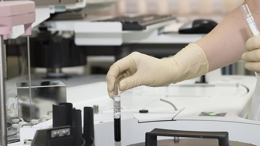 Vücutta gizlenen tümör, bağışıklık sistemini harekete geçiren "immünoterapi" ile yok ediliyor