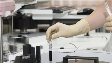 Vücutta gizlenen tümör, bağışıklık sistemini harekete geçiren "immünoterapi" ile yok ediliyor