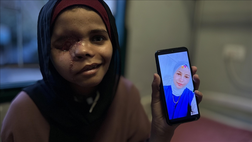 زندگی ندا، دختر 15 ساله غزه‌ای، پس از حمله اسرائیل تاریک شد