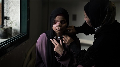 İsrail saldırısı nedeniyle yüzü tanınmaz hale gelen 15 yaşındaki Gazzeli Neda'nın "hayatı karardı"