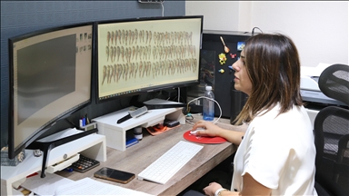 Akademisyenler Karadeniz'de bazı balık türlerinde mikroplastikleri araştırdı