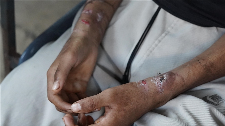 Filistinli esir Nebhan, İsrail cezaevlerinde kullanılan yeni işkence yöntemi "tabut"u ifşa etti