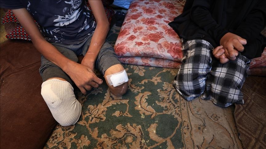 Газа является местом с самым высоким в мире количеством детей-инвалидов