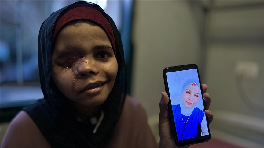 ندى أرحومة.. طفلة سرقت إسرائيل عينها وغيبت ضحكتها 