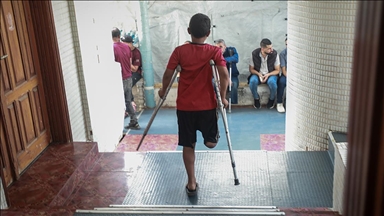 Палестинците во Газа кои ги загубија своите екстремитети имаат ограничен пристап до протези за екстремитети