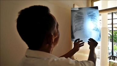 Tuberculosis kills over 1.2M yearly as global funding falters, WHO warns