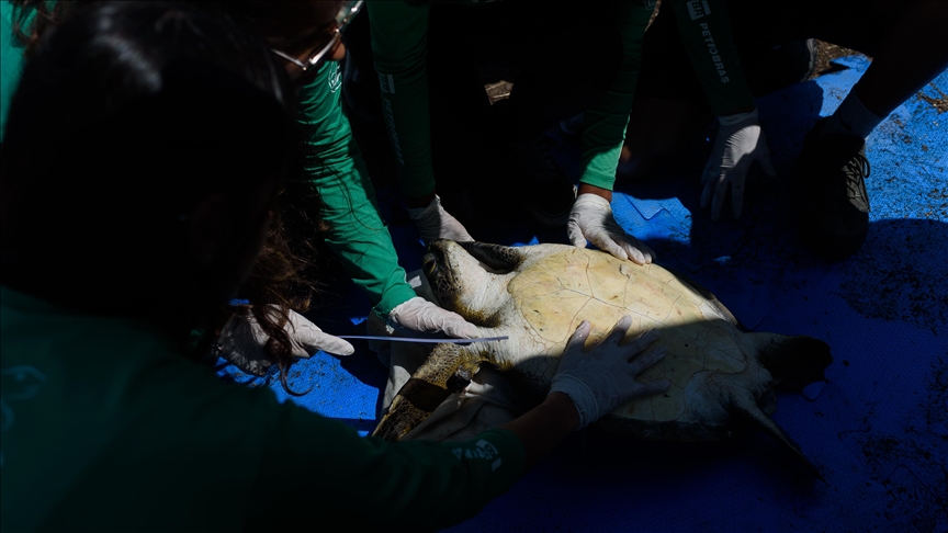 Polish doctors remove 35-pound tumor after man’s symptoms attributed to poor lifestyle