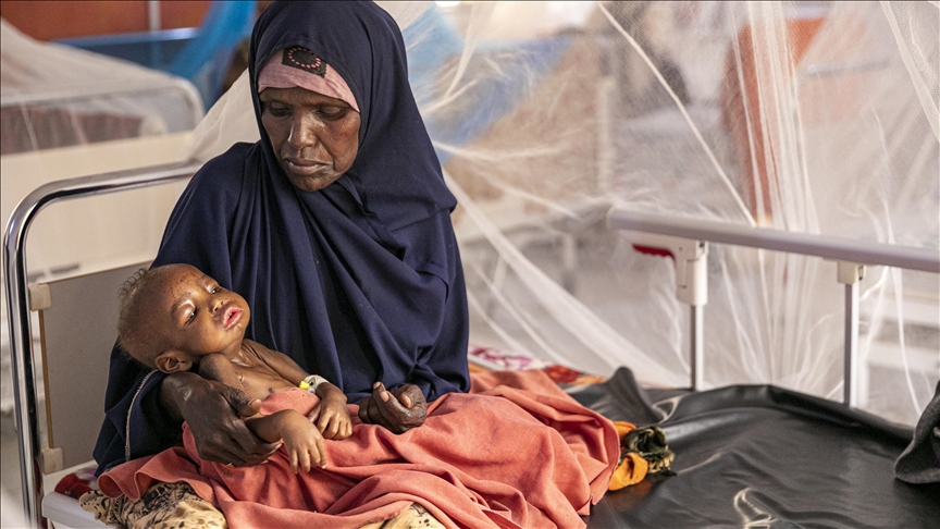 WFP  Një e katërta e popullsisë së Somalisë përballet me uri akute