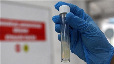 ВОЗ: Ежегодно от туберкулеза умирает миллион человек