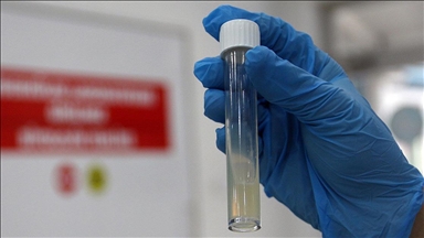 DSÖ: Tüberküloz nedeniyle her yıl bir milyon kişi hayatını kaybediyor