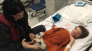 Başkentte pitbull cinsi köpeğin saldırısına uğrayan 2 çocuk yaralandı