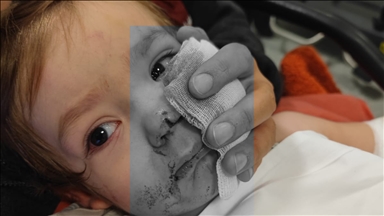 Başkentte 2 çocuğu yaralayan pitbull cinsi köpeğin sahibi gözaltına alındı