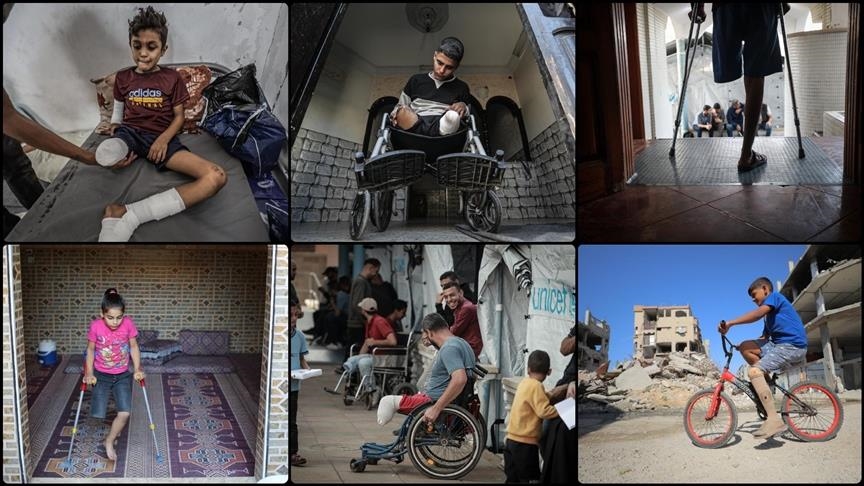 Ministria e Shëndetësisë në Gaza: 6.000 persona të amputuar kanë nevojë për rehabilitim urgjent
