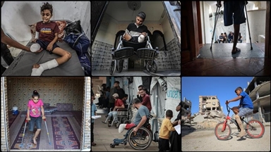 6,000 amputees need urgent long-term rehabilitation in Gaza, Health Ministry says