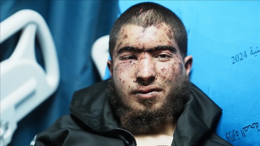 شاب فلسطيني يروي للأناضول تفاصيل تعذيبه على يد مستوطنين غربي رام الله (مقابلة)