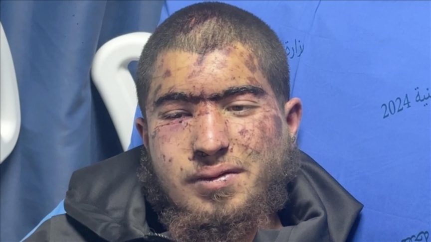 Vücudu işkence izleriyle kaplı Filistinli genç, gaspçı İsrailliler ile askerin uyguladığı vahşeti AA'ya anlattı