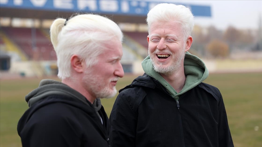 Albinizmli antrenörlük öğrencisi arkadaşlar zorlukları dayanışmayla aşıyor