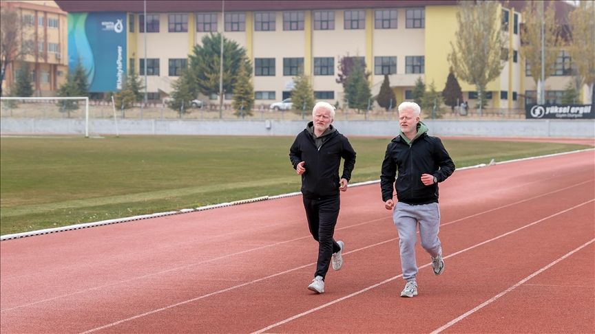 Studentët me albinizëm i kapërcejnë sfidat nëpërmjet solidaritetit