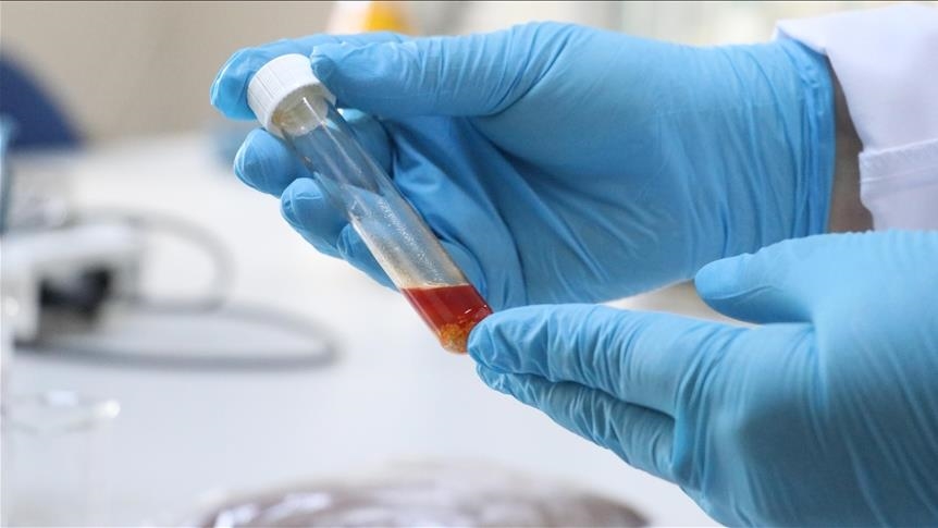 باحثون أتراك ينتجون زيتا أحادي الخلية من بقايا العنب 