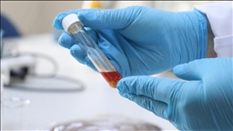 باحثون أتراك ينتجون زيتا أحادي الخلية من بقايا العنب 