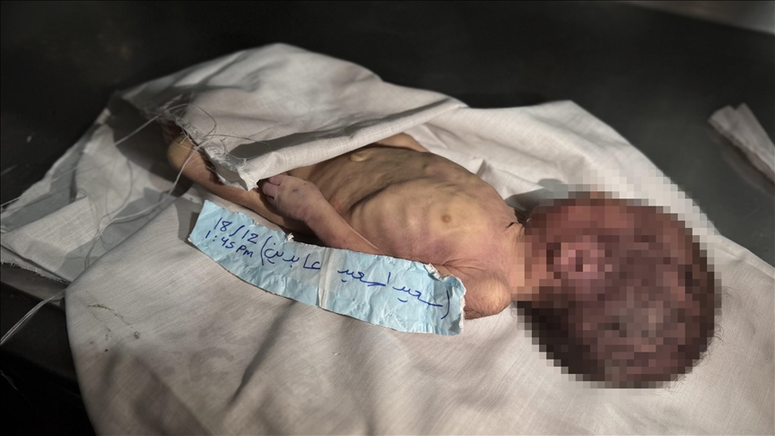Gazze'de şiddetli soğuk nedeniyle bir aylık bebek hayatını kaybetti