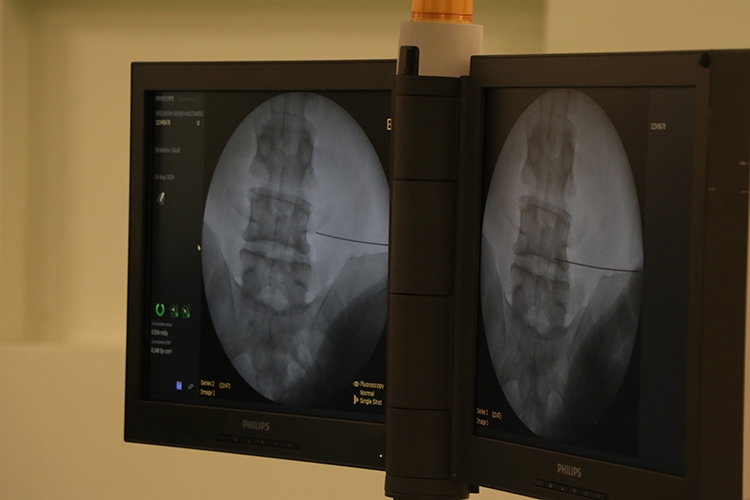 Fıtıkla uzun süre yaşamak ciddi risklere neden olabiliyor