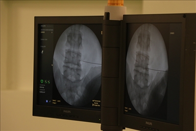 Fıtıkla uzun süre yaşamak ciddi risklere neden olabiliyor