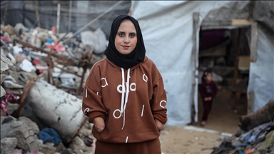 فلسطينية بغزة: فقدان يديّ سجن سلبني أحلامي وأعاق أمومتي