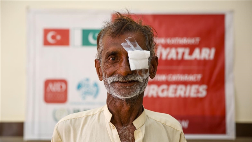 ترکیه سال 2025 بیش از 17 هزار بیمار آب‌مروارید را در 16 کشور جراحی کرد
