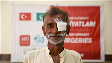 ترکیه سال 2025 بیش از 17 هزار بیمار آب‌مروارید را در 16 کشور جراحی کرد