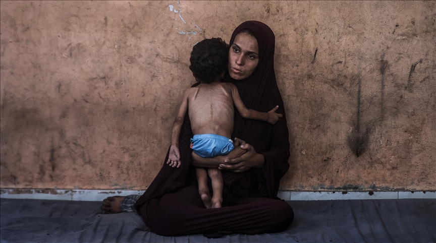 OKB ja raporton gati 95 000 raste të kequshqyerjes së fëmijëve në Rripin e Gazës në vitin 2025