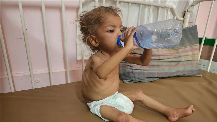 UN reports nearly 95,000 child malnutrition cases in Gaza Strip in 2025