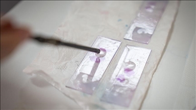 Trafic de pesticides interdits : six maraîchers jugés à Marseille sur fond de durcissement des règles