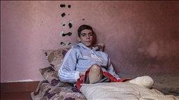 غزة.. لغم إسرائيلي أفقد الشاب داود ساقيه وسلبه أحلامه 