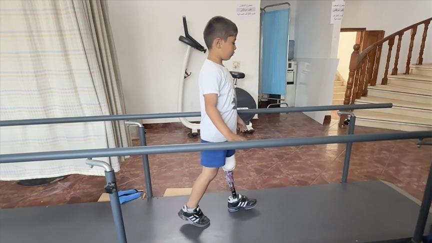 جمعية تركية تركب أطرافا صناعية لمصابين فلسطينيين من غزة