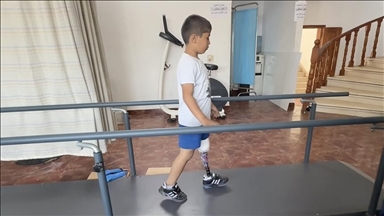 جمعية تركية تركب أطرافا صناعية لمصابين فلسطينيين من غزة